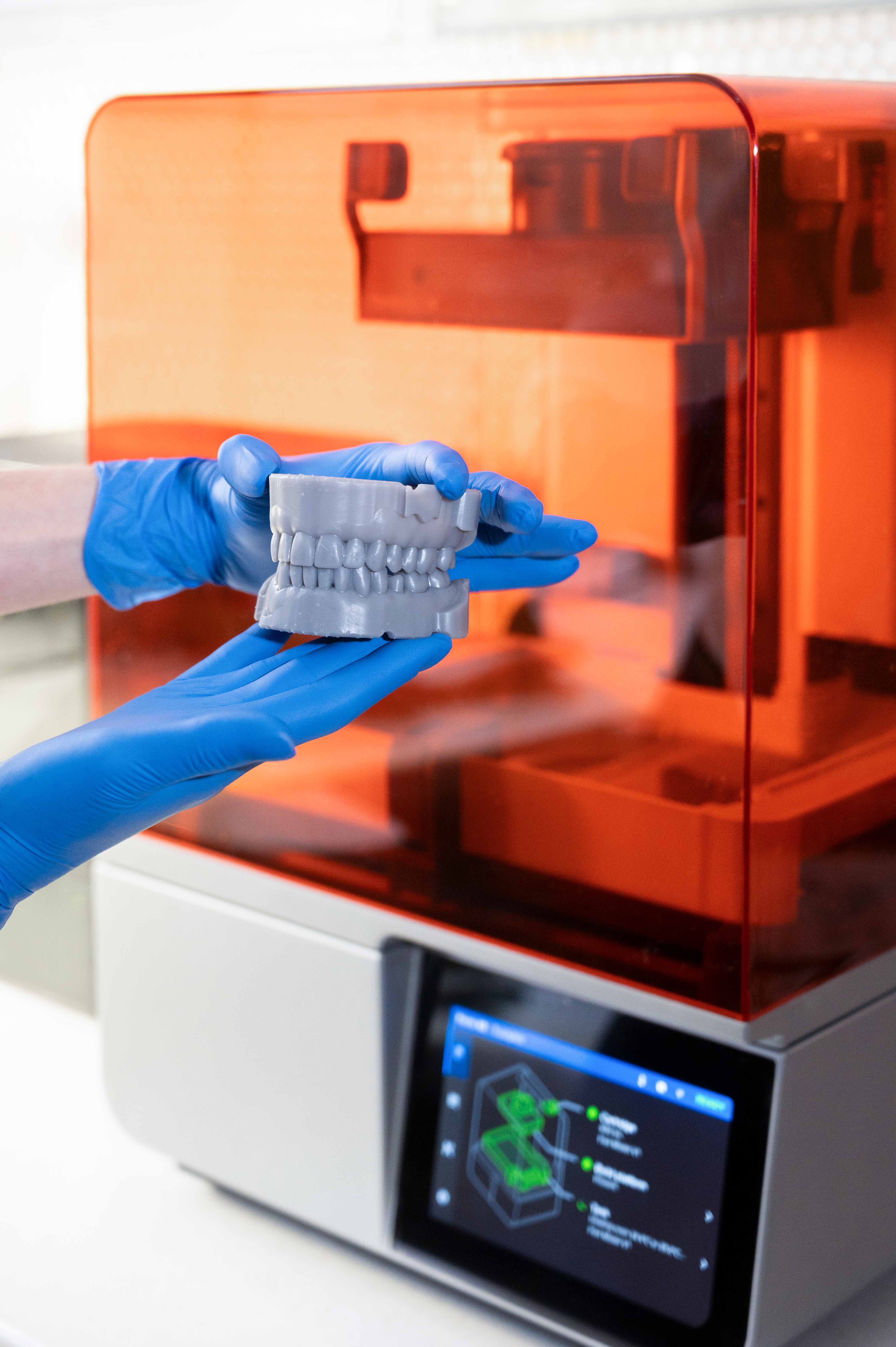 kieferorthopaedie-mueller-3d-druck