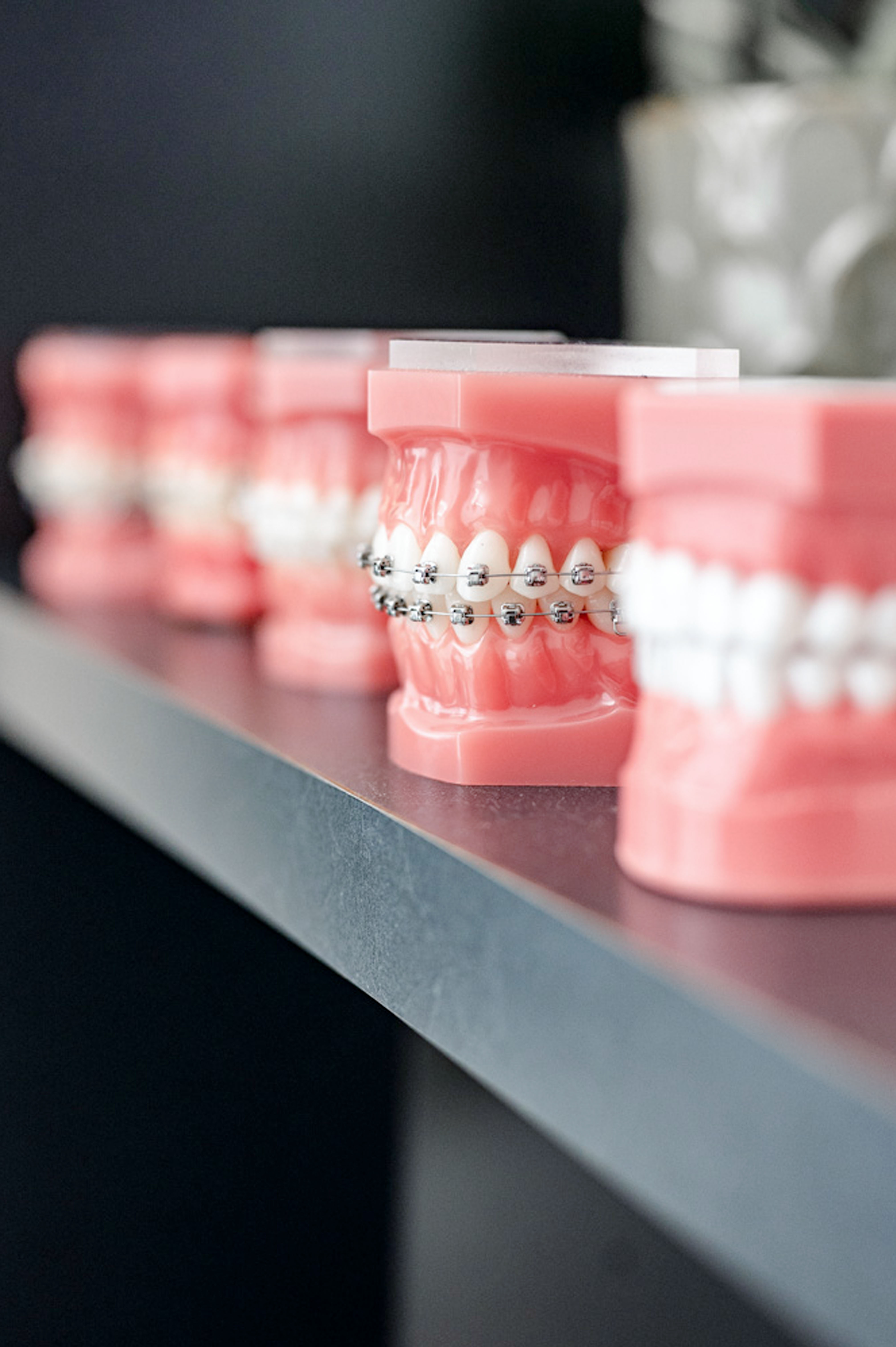 kieferorthopaedie-mueller-modelle-detail